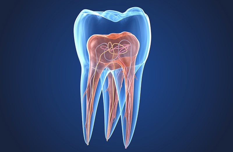 Endodontie / Wurzelbehandlung